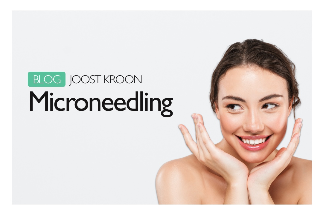 Microneedling, de huid verjongt zichzelf